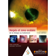 Herpès et zona oculaire