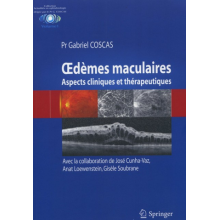 Oedèmes maculaires 