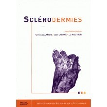 Sclérodermies 