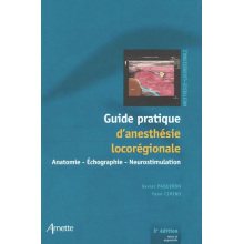 Guide pratique d'anesthésie locorégionale