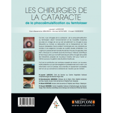 Les chirurgies de la cataracte