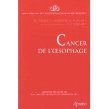 Cancer de l'œsophage