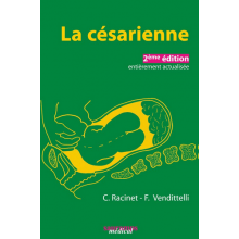 La césarienne