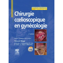 Chirurgie cœlioscopique en...