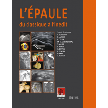 L'épaule : du classique à l'inédit