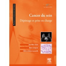 Cancer du sein