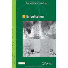 Embolisation