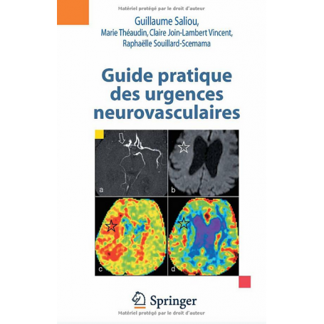 Guide pratique des urgences neurovasculaires