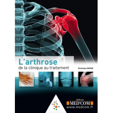 L'arthrose : de la clinique...