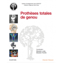 Prothèses totales du genou