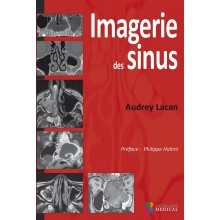 Imagerie des sinus