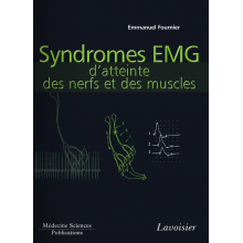 Syndromes EMG d'atteinte des muscles