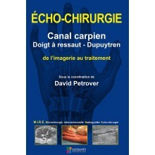 Echo-chirurgie : canal carpien