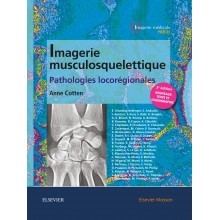 Imagerie musculosquelettique : pathologies locorégionales