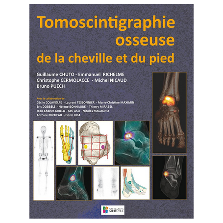 Tomoscintigraphie osseuse de la cheville et du pied Collectif