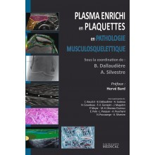 Plasma enrichi en plaquettes en pathologie musculosquelettique