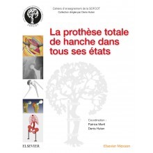 La prothèse totale de hanche dans tous ses états