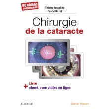 Chirurgie de la cataracte