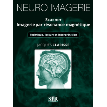 Neuro-imegerie : scanner, imagerie par résonance magnétique