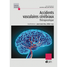 Accidents vasculaires cérébraux