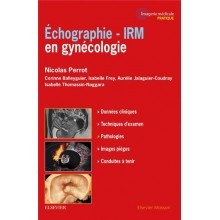 Echographie, IRM en gynécologie