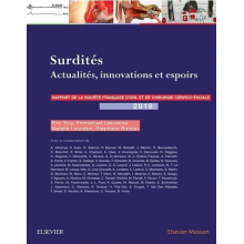 Surdités