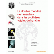 La double mobilité dans les prothèses totales de hanche